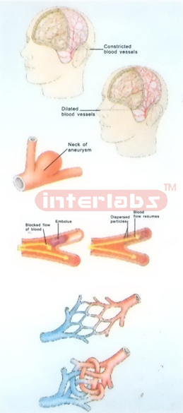 HUMAN YOUNG HAEMORRHAGE MODEL FOR DEMONSTRATING